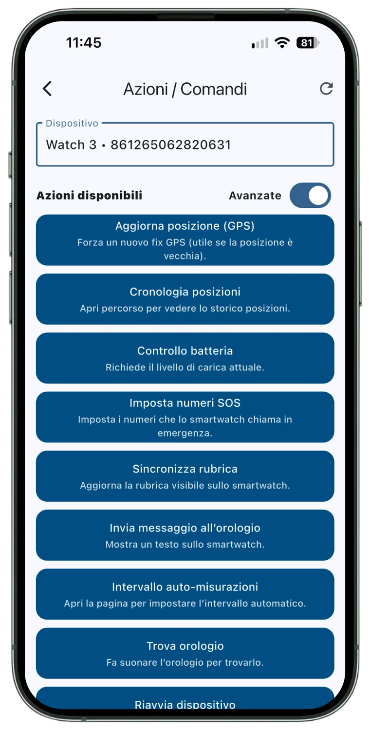 Azioni e comandi CareWatch